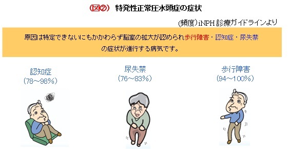 特発性正常圧水頭症の症状